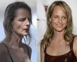 Helen Hunt i operacje plastyczne: prawda czy mit? Analiza zmian