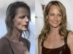 Helen Hunt i operacje plastyczne: prawda czy mit? Analiza zmian